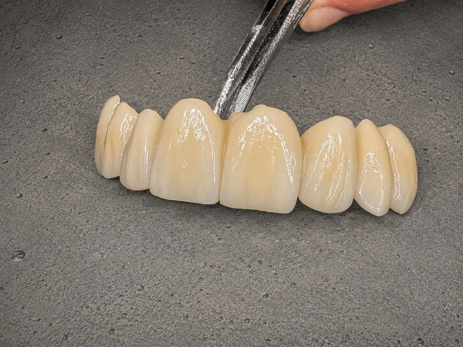 Most ceramiczny wykonany w pracowni Estetic Studio
